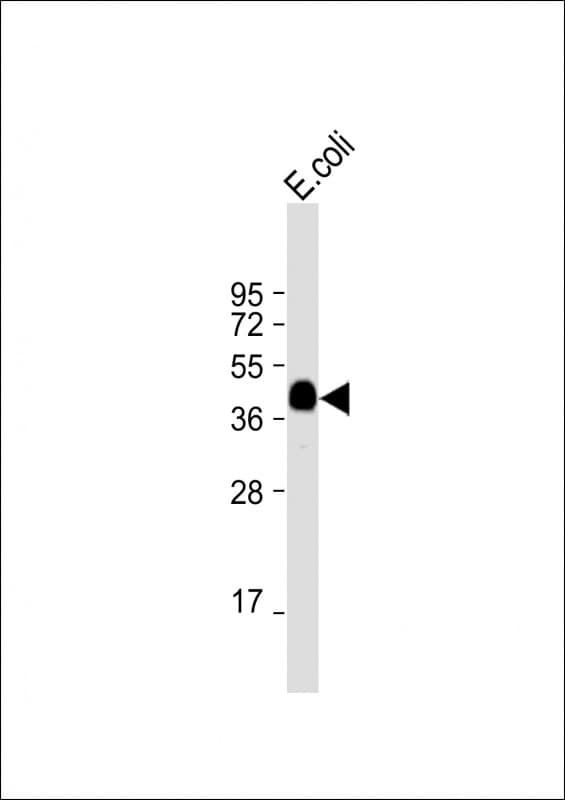 MBP Tag Antibody