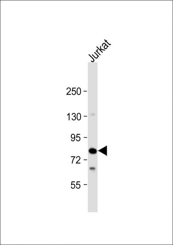 Polyclonal Rabbit anti-Human LCP2 / SLP-76 Antibody (N-Terminus, WB)