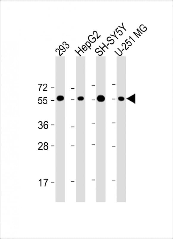 Polyclonal Rabbit anti-Human PEPD / PROLIDASE Antibody (C-Terminus, WB)