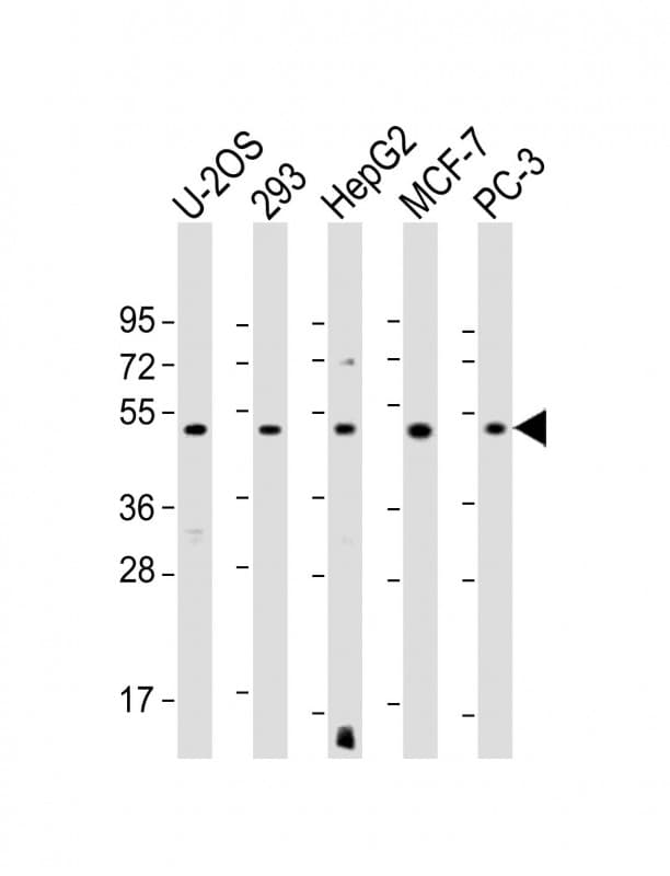 EEF1A1P5 Antibody (C-Terminus)