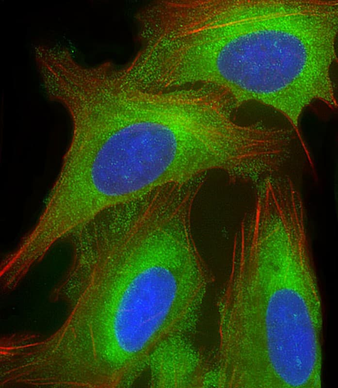 EEF1A1P5 Antibody (C-Terminus)