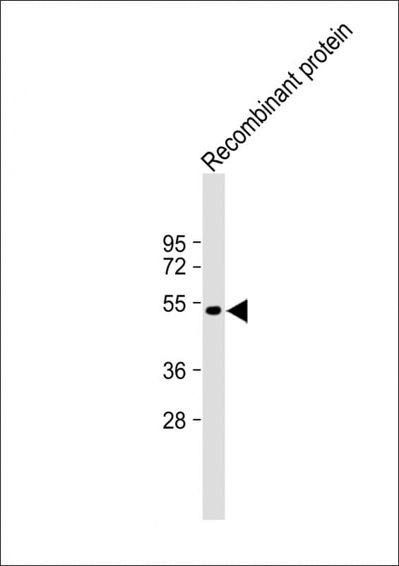 Polyclonal Rabbit anti-Human TrpE Antibody (WB)