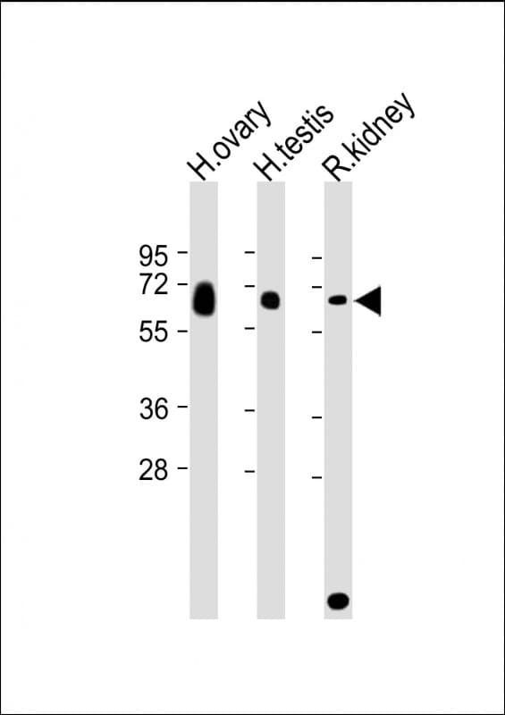 Polyclonal Rabbit anti-Human GGT3P Antibody (C-Terminus, WB)