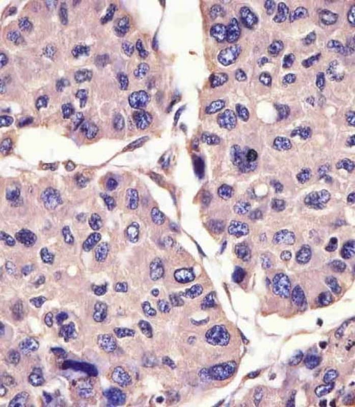 CANX / Calnexin Antibody (C-Terminus)