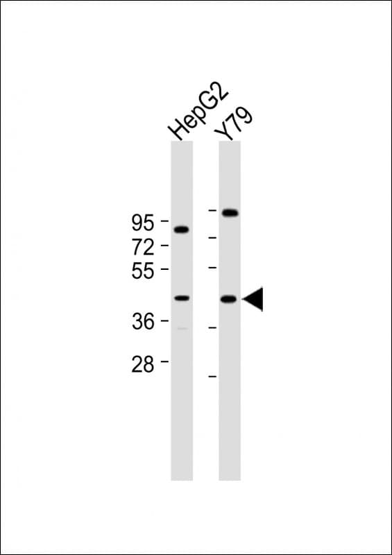 Polyclonal Rabbit anti-Human Prostaglandin D2 Receptor Antibody (C-Terminus, WB)