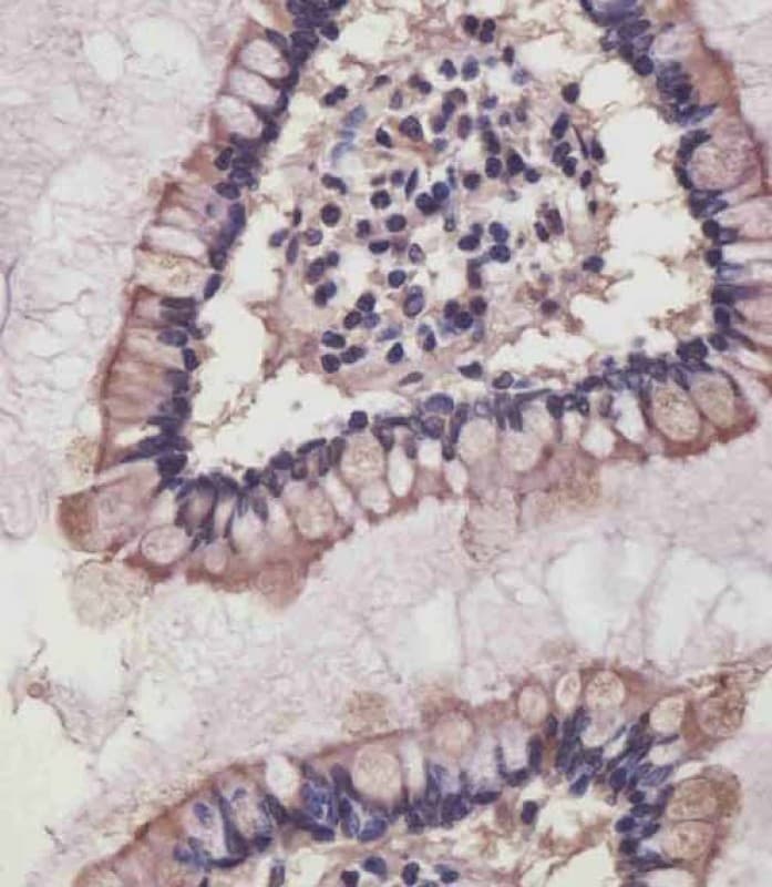 Polyclonal Rabbit anti-Human NRAS / N-ras Antibody (IHC, WB)