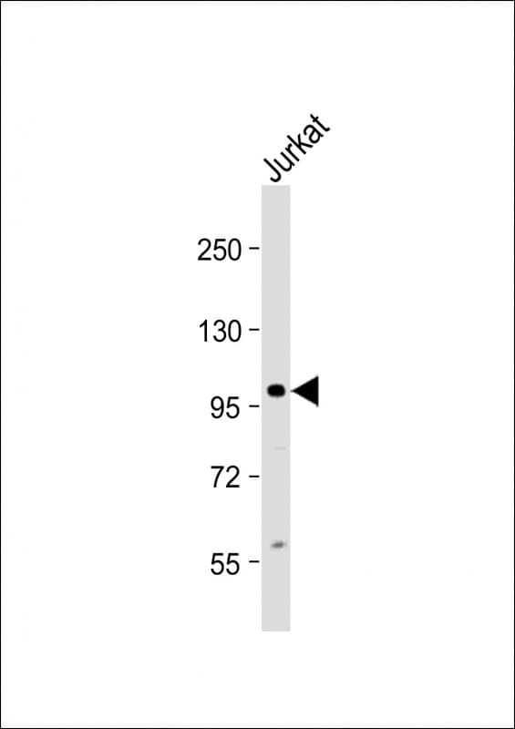 Polyclonal Rabbit anti-Human KIAA1524 / p90 Autoantigen Antibody (Internal, WB)