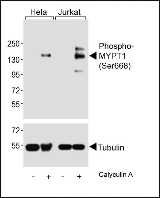 Polyclonal Rabbit anti-Human PPP1R12A / MYPT1 Antibody (phospho-Ser668, WB)