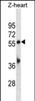 TEAD1 Antibody (C-Terminus)