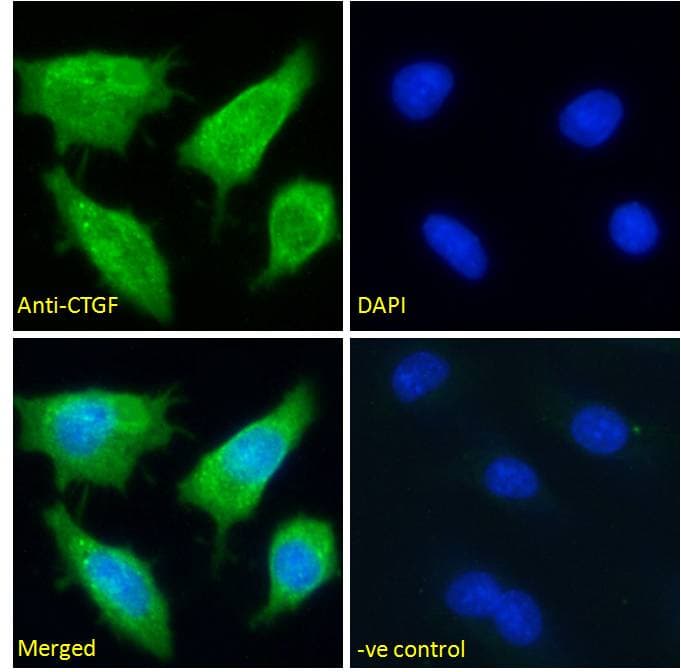 Polyclonal Goat anti-Human CTGF Antibody (C-Terminus, IF)