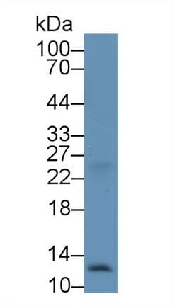 Polyclonal Rabbit anti-Human SDF1 / CXCL12 Antibody (aa23-89, WB)