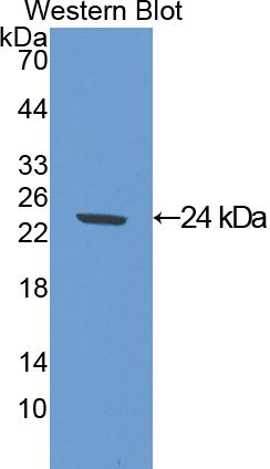 SOD2 / Mn SOD Antibody (aa25-222)