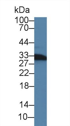 Polyclonal Rabbit anti-Rat CD74 / CLIP Antibody (PE, WB)
