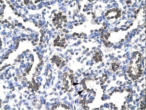 Polyclonal Rabbit anti-Human FOSB Antibody (HRP, aa240-289, IHC, WB)