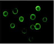 BTK Antibody (clone 7F12H4)