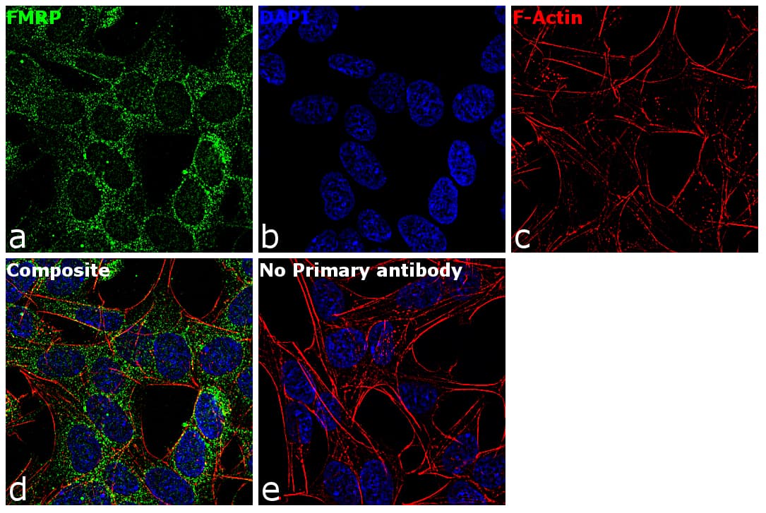 Monoclonal Mouse anti-Human FMR1 / FMRP Antibody (clone 4G9, IHC, IF, WB)