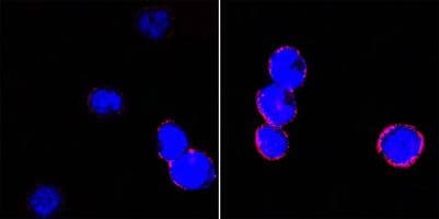 ITGB2 / CD18 Antibody (clone 1E+13)