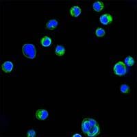 ITGB2 / CD18 Antibody (clone 1E+13)