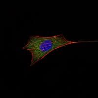 BCL2 / Bcl-2 Antibody (clone 8E+12)