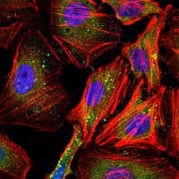 CCNB1 / Cyclin B1 Antibody (clone 5G6)