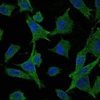 MAP2K6 / MEK6 / MKK6 Antibody (clone 3H12C8)