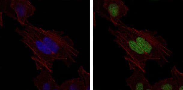 Monoclonal Mouse anti-Human MSH6 Antibody (clone 30, IHC, IF, WB)