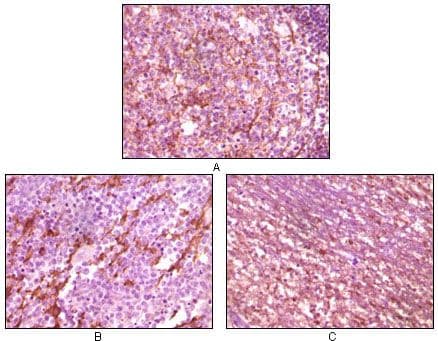 Monoclonal Mouse anti-Human DNM1 / Dynamin Antibody (clone 3G4B6, IHC, WB)