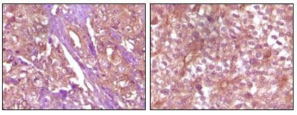 EPHB4 / EPH Receptor B4 Antibody (clone 5B8F7)