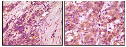 Monoclonal Mouse anti-Human FBLN5 / Fibulin 5 Antibody (clone 3F10A5, 3F8A12, IHC, WB)