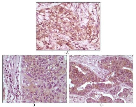 EIF4EBP1 / 4EBP1 Antibody (clone 4B6G10)