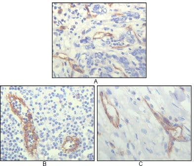 PECAM-1 / CD31 Antibody (clone 2F7B2)