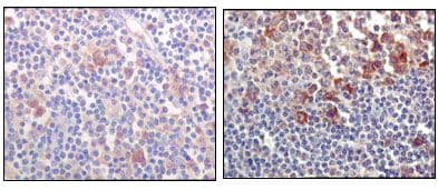 BTK Antibody (clone 7F12H4)