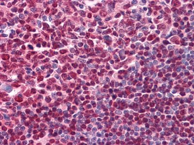 Monoclonal Mouse anti-Human CD20 Antibody (clone 3E9D3C1G3, EPANPSEKNSPSTQY, IHC, IF)