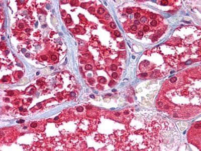 Monoclonal Mouse anti-Human GPI Antibody (clone 1B7D7, IHC, IF, WB)