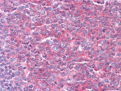 KARS Antibody (Amino Acid: 90-174, clone 8G12C1)
