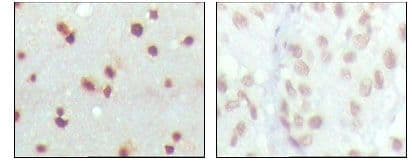 MDM4 / MDMX Antibody (clone 2D10F4)