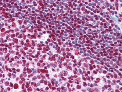 MDM4 / MDMX Antibody (clone 2D10F4)