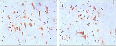 Monoclonal Mouse anti-Human FMR1 / FMRP Antibody (clone 4G9, IHC, IF, WB)