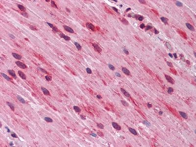Monoclonal Mouse anti-Human GATA3 Antibody (clone 7B5, IHC, WB)