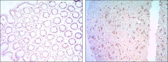 BCL2 / Bcl-2 Antibody (clone 8E+12)