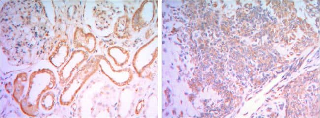 Monoclonal Mouse anti-Human HK1 / Hexokinase 1 Antibody (clone 7A7, IHC, IF, WB)