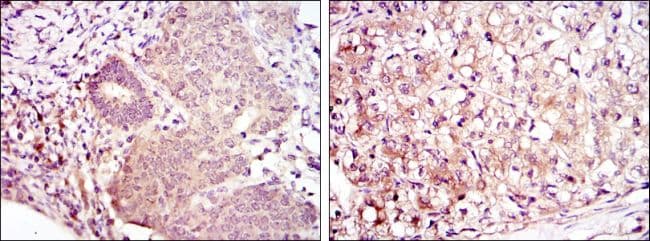 Monoclonal Mouse anti-Human MAP2K6 / MEK6 / MKK6 Antibody (clone 3H12B9, IHC, WB)