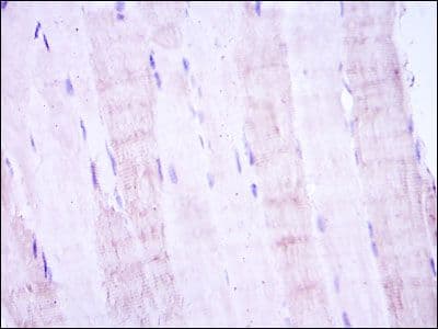 MAP2K4 / MKK4 Antibody (clone 5H4)