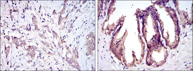 Monoclonal Mouse anti-Human MAP3K5 / ASK1 Antibody (clone 20000, IHC, IF, WB)