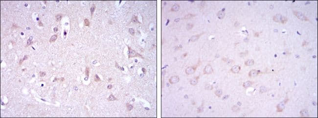 Monoclonal Mouse anti-Human GRIA3 / GLUR3 Antibody (clone 1D2, IHC, WB)