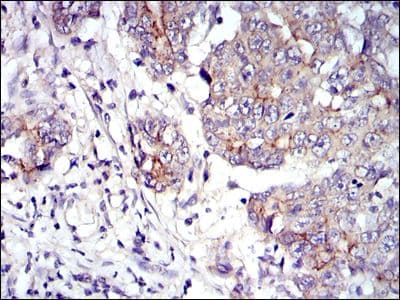 Monoclonal Mouse anti-Human JUP/CTNNG/Junction Plakoglobin Antibody (clone 4C12, IHC, IF, WB)