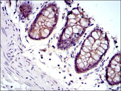 Monoclonal Mouse anti-Human JUP/CTNNG/Junction Plakoglobin Antibody (clone 4C12, IHC, IF, WB)