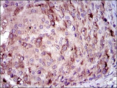CRP / C-Reactive Protein Antibody (clone 1G1)