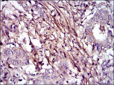 Monoclonal Mouse anti-Human FN1 / Fibronectin Antibody (clone 2F4, IHC, WB)