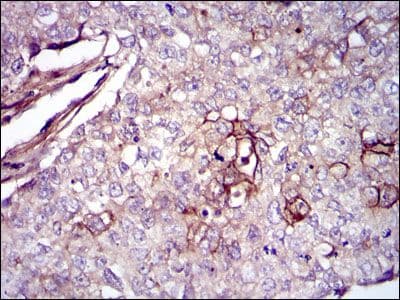 Monoclonal Mouse anti-Human FN1 / Fibronectin Antibody (clone 2F4, IHC, WB)